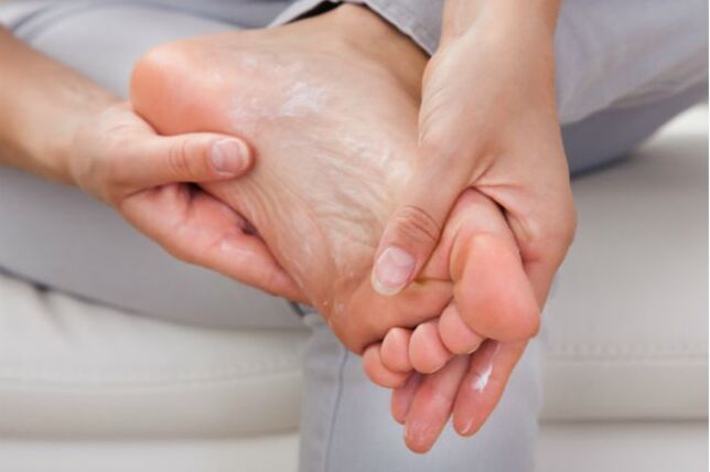 Les crèmes et gouttes antifongiques aideront dans les premiers stades de la mycose des ongles des pieds. 