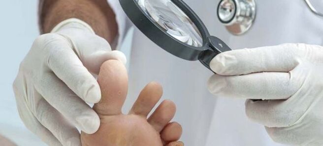 Examens avant de commencer un traitement fongique