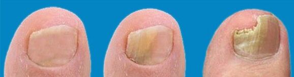 Processus de développement du champignon