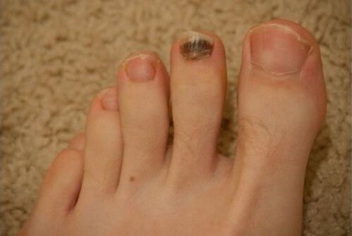 Utilisation de médicaments oraux et topiques