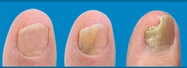 processus de développement fongique