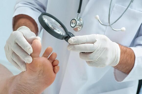 causes et traitement des champignons sur les ongles des pieds